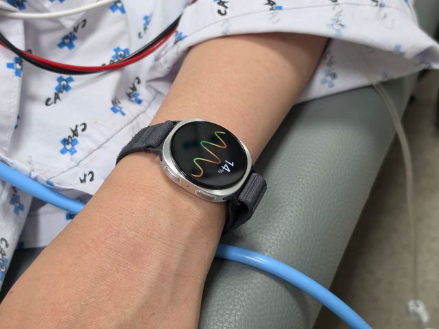 Galaxy Watch en la muñeca de un paciente con una vía intravenosa durante el estudio
